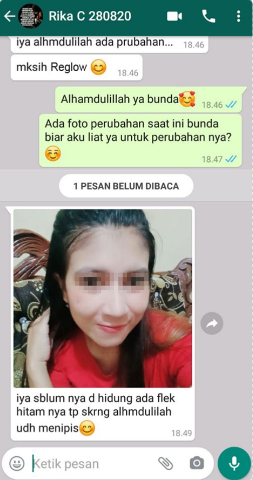 imgonline com ua CompressToSize 4sDrk9wbsdnM 1