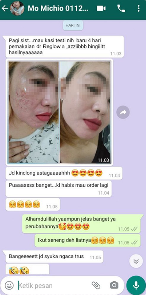 imgonline com ua CompressToSize 6bOdpukXC7SHMKKN 1 1 1