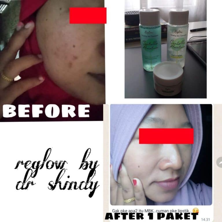 Testimoni Reglow 2023 4